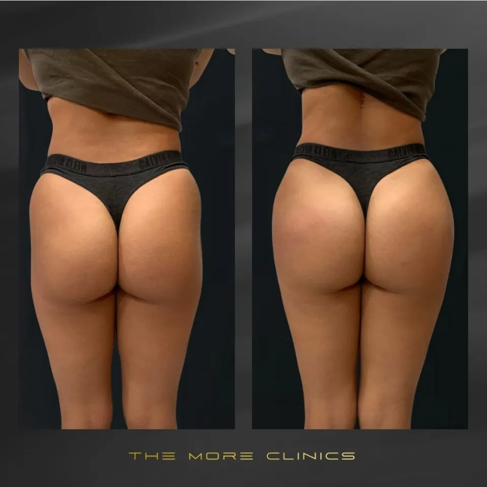 Aesthetic before & after 12