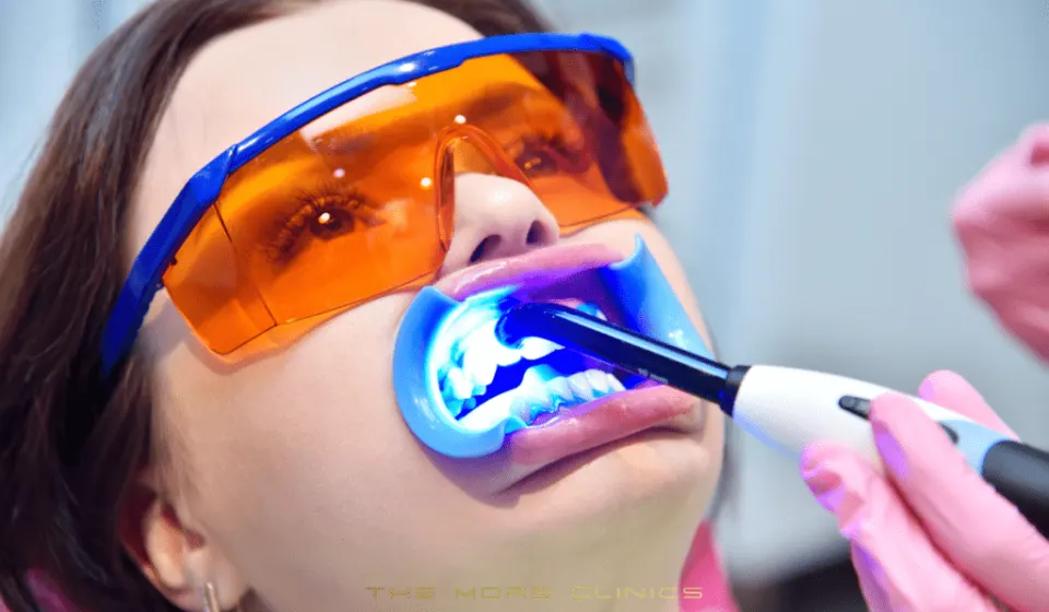 Antalya Teeth Whitening Turkey