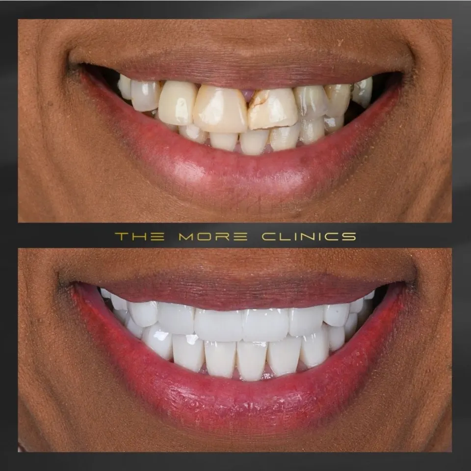 Dental before & after 18