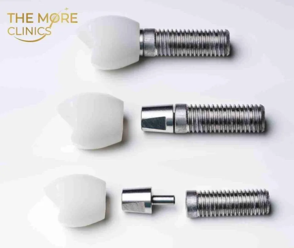Dental Implant in Turkey: Cost, Brands & Modern Solutions