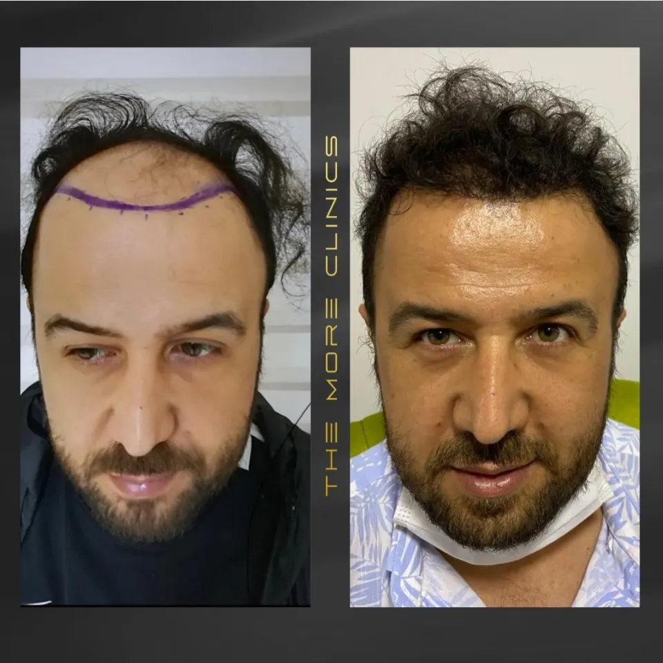 Hair before & after 27