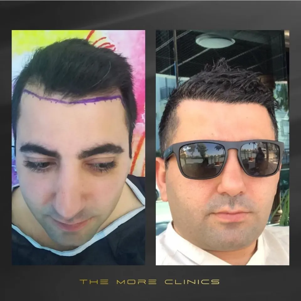 Hair before & after 24